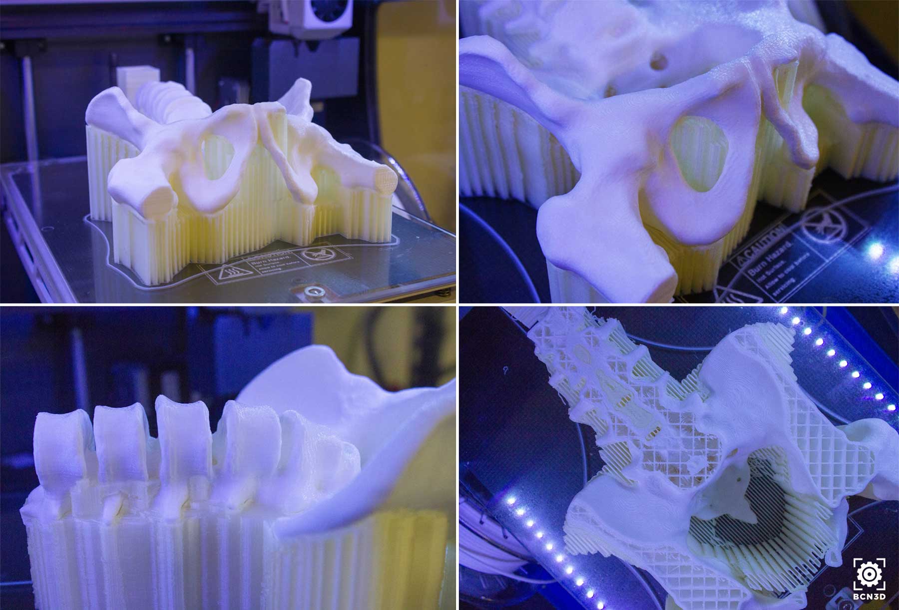 BCN3D_Technologies_BCN3D_Sigma_PLA_PVA_scan_pelvis_replica_all