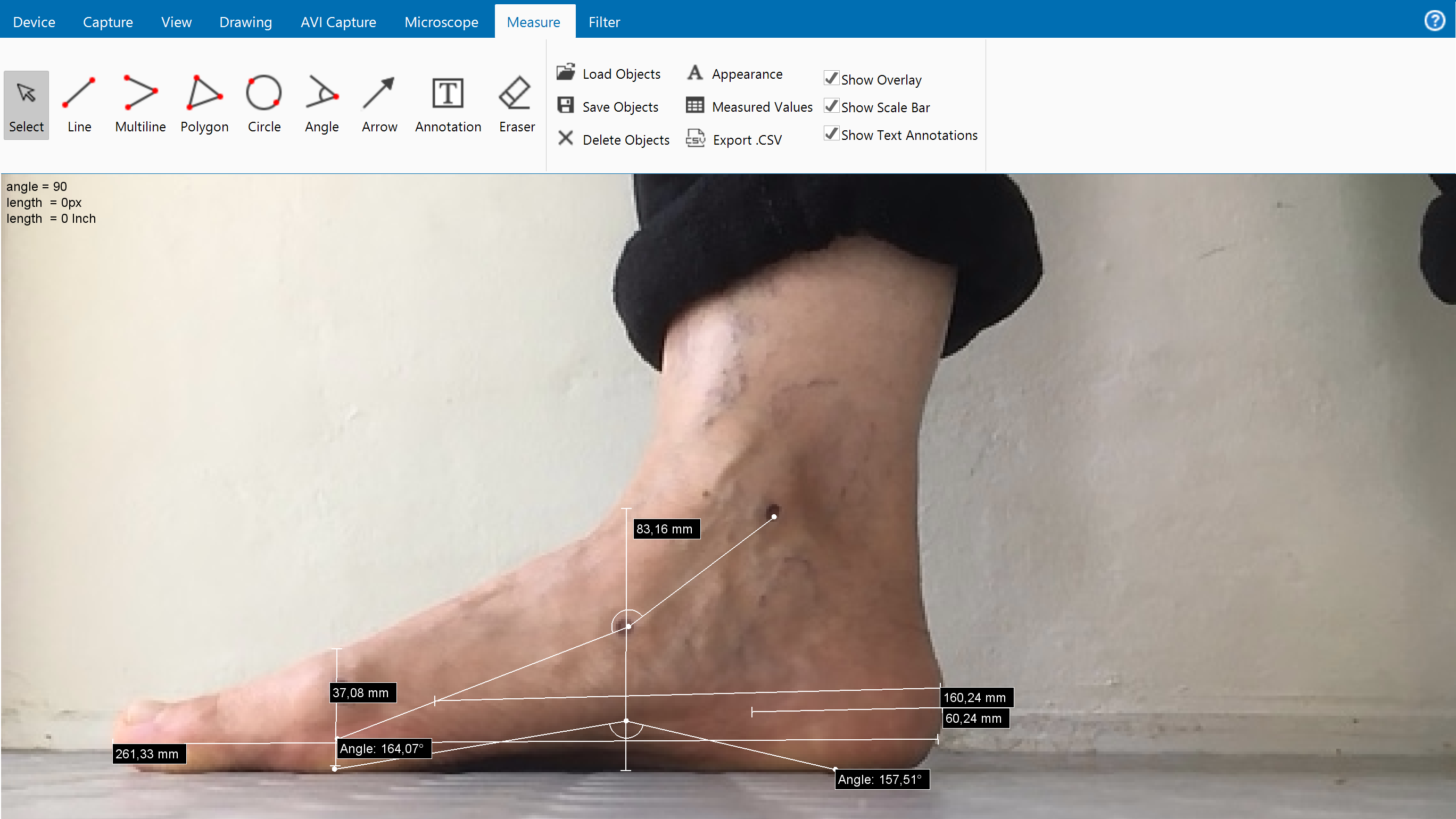 Measuring for 3D printed insoles