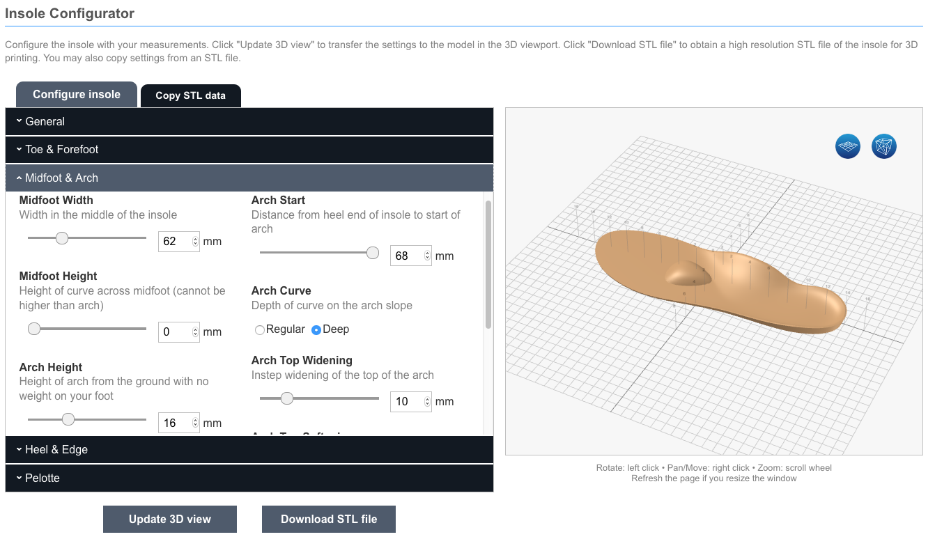 The making of 3D printed insoles