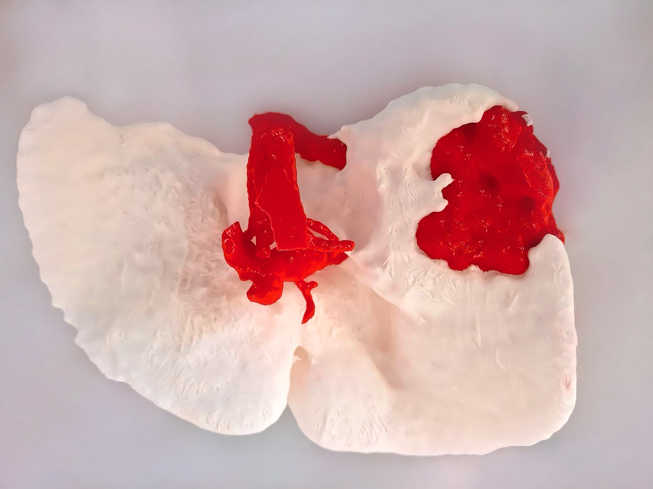 3D Liver Biomodel Back