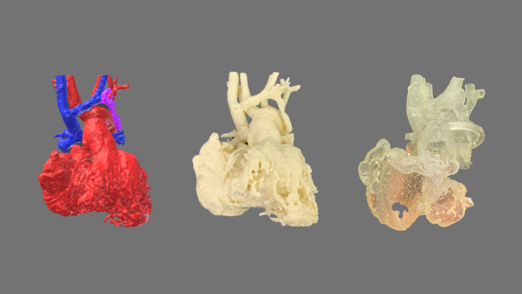 Heart 3D biomodel