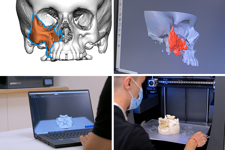 Process of creating 3D anatomical models