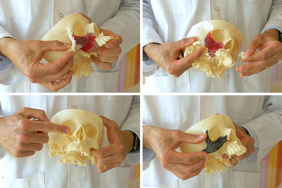 3D printed anatomical models